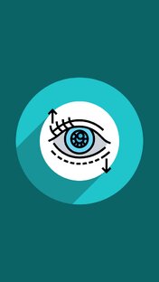 Блефаропластика