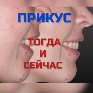 АНОМАЛИИ ПРИКУСА: ВЧЕРА И СЕГОДНЯ