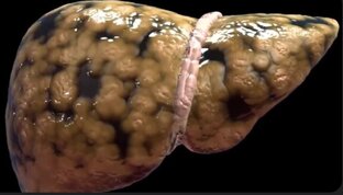 Здоровая печень 