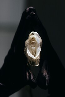 ИНТИМНАЯ ПЛАСТИКА