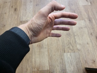 Необычные болезни