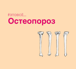 Остеопороз