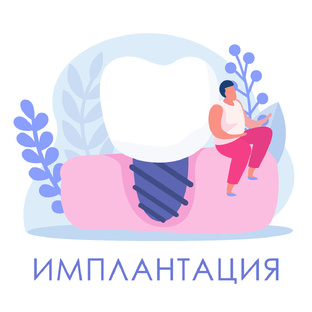 Имплантация