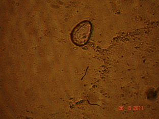 Бактерии в действии