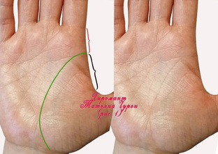 Линия жизни