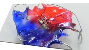 Исправление прикуса у детей