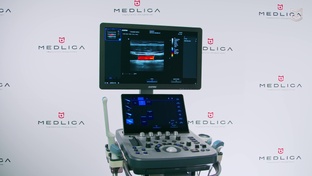 УЗИ аппараты EVORAY