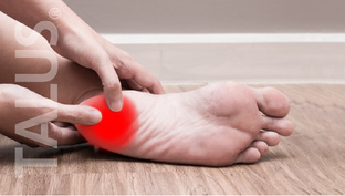 Лечение пяточной шпоры