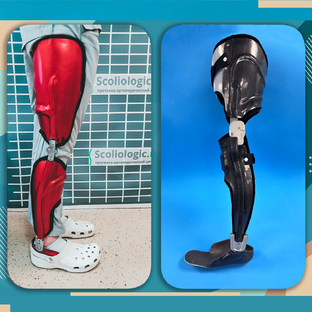  Ортезы, аппараты и туторы