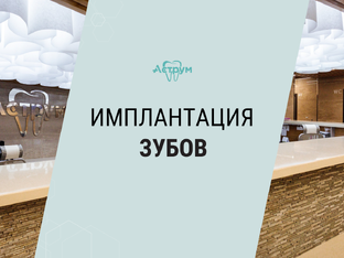 ИМПЛАНТАЦИЯ ЗУБОВ