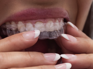 Статьи о здоровье зубов