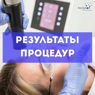 Результаты процедур