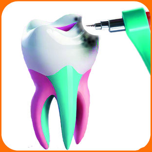 Лечение зубов