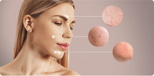 Контурная пластика 