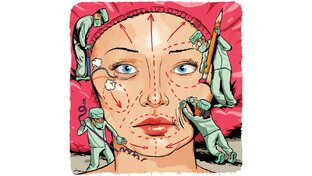  я - "жертва" пластики