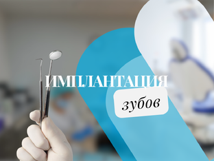 ИМПЛАНТАЦИЯ