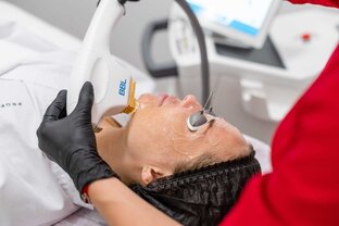 Фототерапия BBL