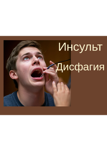 Дисфагия. Видео уроки