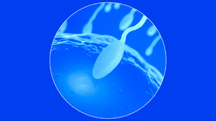 Спермограмма: что это такое