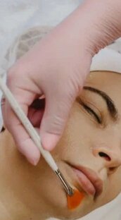 Химические пилинги и кислоты 