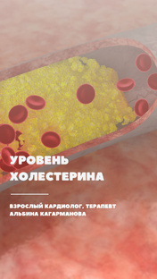 Холестерин 
