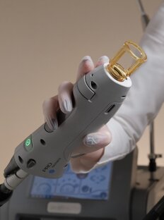 ЛАЗЕРНАЯ ЭПИЛЯЦИЯ