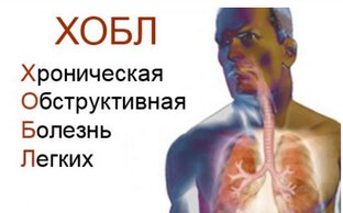 ХОБЛ