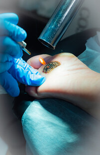 Новообразования. Описание.