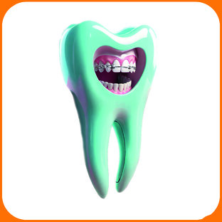 Исправление прикуса