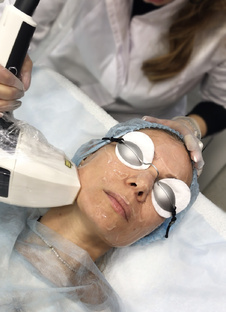 ЛАЗЕРНОЕ ОМОЛОЖЕНИЕ | Москва