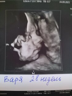 Первые фото детей, они пожоди на папу