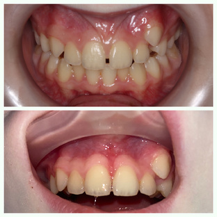 Немного хирургии 