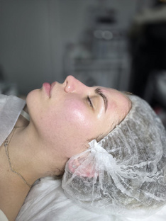 Уход за кожей лица 