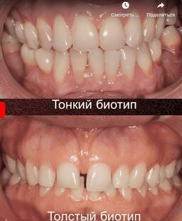 Мягкотканная интеграция