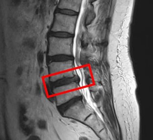 Истории пациентов: после лечения