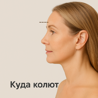 Куда колют ботокс: зоны, эффект и нюансы