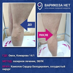 До/после