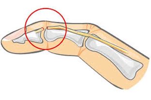 ТРАВМАТОЛОГИЯ 