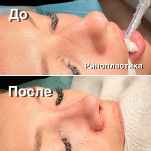 Фото До и После