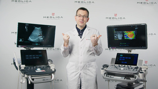 Сравнения УЗИ аппаратов