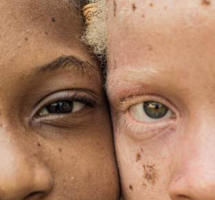 Варианты поддержки фонда