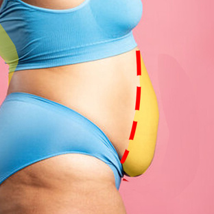 Худеем в животе