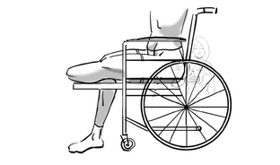 Контрактура 