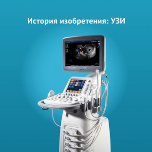 История изобретения 