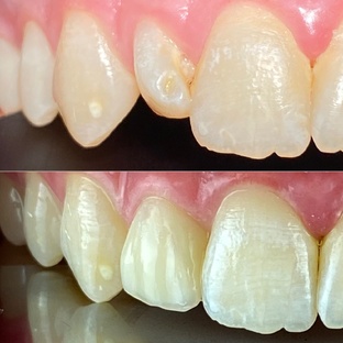 Клинические случаи