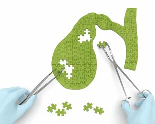 Желчный пузырь 