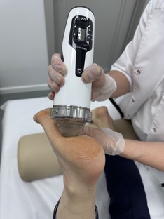 Пяточная шпора, артрозы суставов, ударно-волновая терапия 