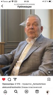 Этюды - лазерное омоложение. 