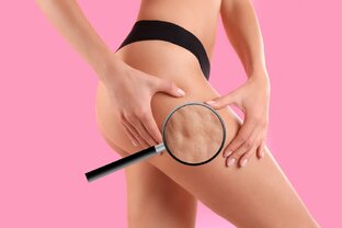 Устранить целлюлит навсегда