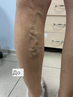 Флебология